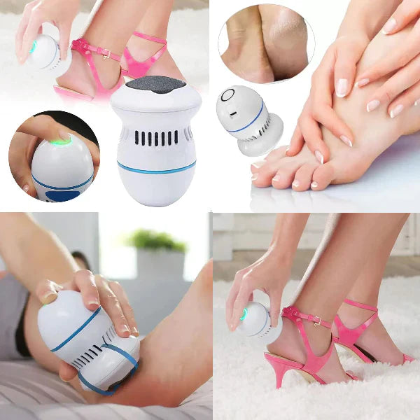 Removedor de Callos Eléctrico con Aspiradora