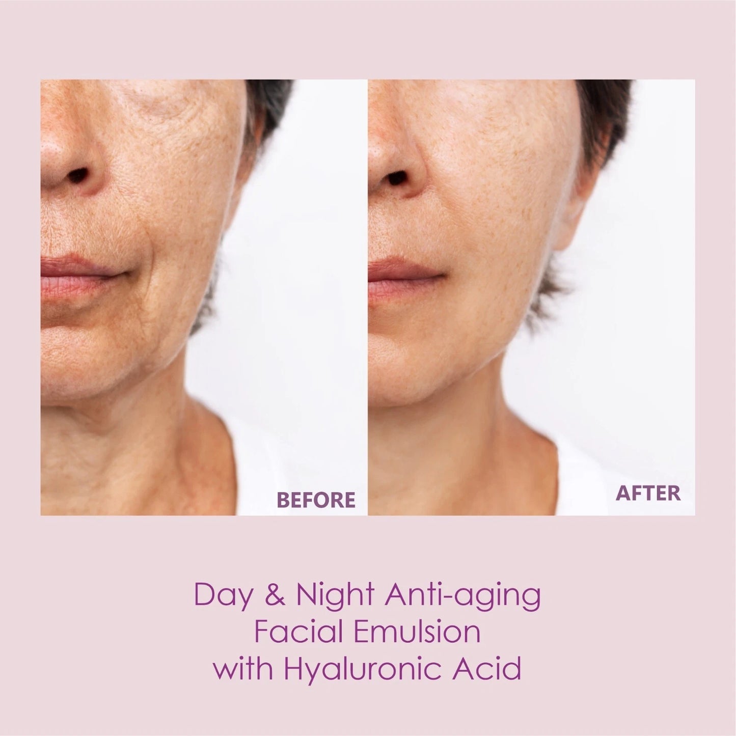 HIALURONIKA Crema Antiarrugas con Ácido Hialurónico